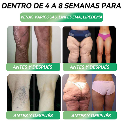 𝐓𝐢𝐞𝐧𝐝𝐚 𝐎𝐟𝐢𝐜𝐢𝐚𝐥 | 𝐇𝐇𝐕𝐁® 👩‍⚕️ 𝐆𝐋𝐏-𝟏 𝐒𝐨𝐥𝐮𝐜𝐢ó𝐧 𝐎𝐫𝐚𝐥 𝟔-𝐞𝐧-𝟏 (𝟏 𝐝𝐨𝐬𝐢𝐬 𝐚𝐥 𝐝í𝐚, 𝐜𝐚𝐦𝐛𝐢𝐨𝐬 𝐯𝐢𝐬𝐢𝐛𝐥𝐞𝐬 𝐞𝐧 𝟕 𝐝í𝐚𝐬) ✅ 𝐏𝐮𝐞𝐝𝐞 𝐚𝐲𝐮𝐝𝐚𝐫 𝐜𝐨𝐧 𝐨𝐛𝐞𝐬𝐢𝐝𝐚𝐝, 𝐬𝐚𝐥𝐮𝐝 𝐜𝐚𝐫𝐝𝐢𝐨𝐯𝐚𝐬𝐜𝐮𝐥𝐚𝐫, 𝐜𝐨𝐧𝐭𝐫𝐨𝐥 𝐝𝐞 𝐥𝐚 𝐝𝐢𝐚𝐛𝐞𝐭𝐞𝐬, 𝐚𝐩𝐧𝐞𝐚 𝐝𝐞𝐥 𝐬𝐮𝐞ñ𝐨, 𝐬𝐚𝐥𝐮𝐝 𝐚𝐫𝐭𝐢𝐜𝐮𝐥𝐚𝐫 𝐲 𝐦á𝐬